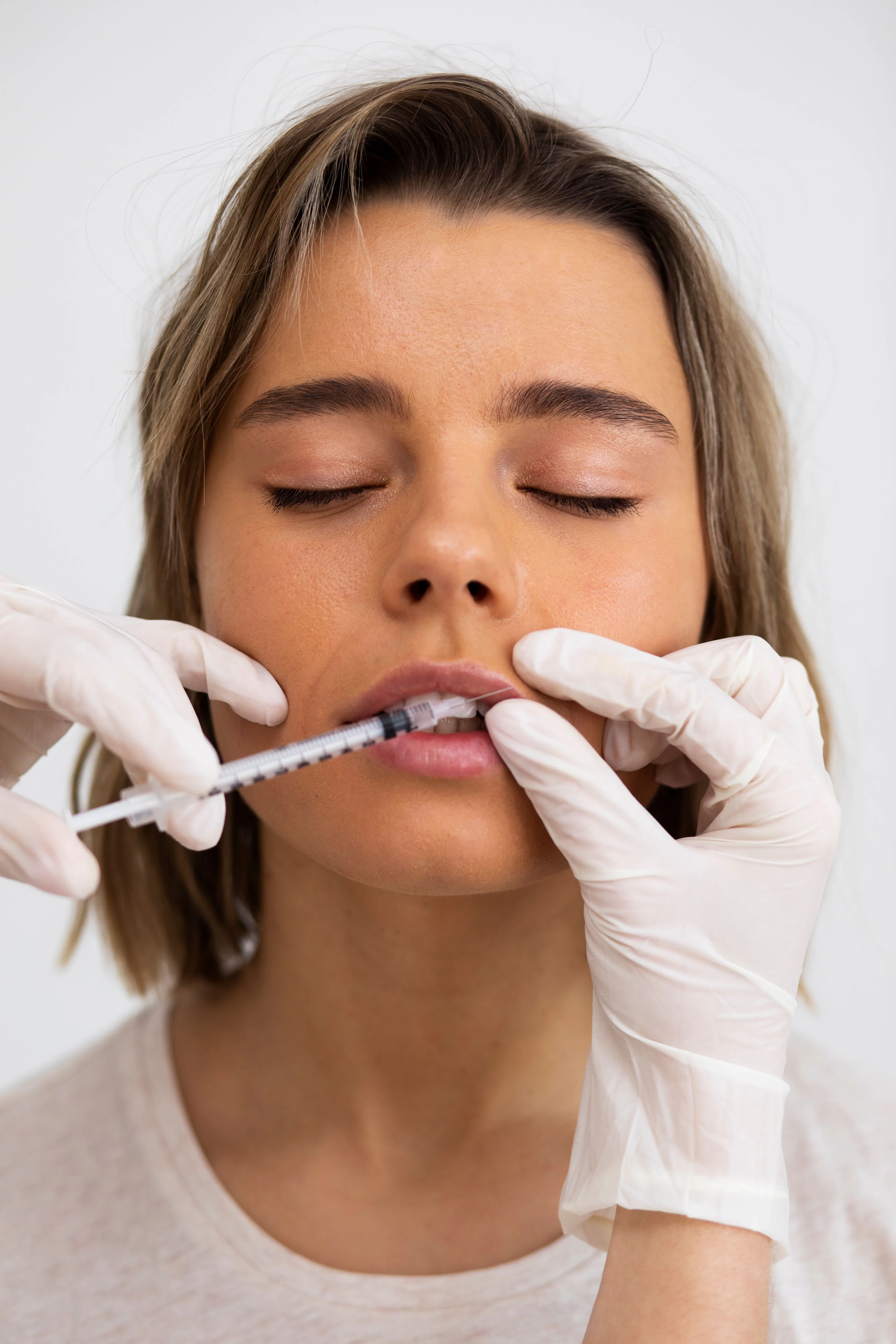 Estética Facial